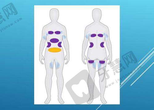 八、总结:男人乳房大是什么原因导致的?及时排查,科学应对