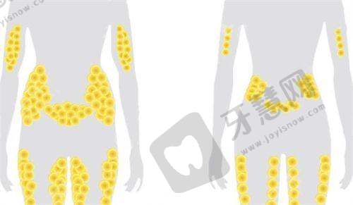 七、男性乳房大怎么减下去?预防复发:长期管理特别重要