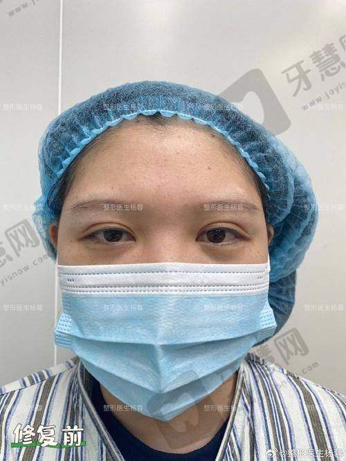 八、唐山惠美登美容医院价格表参考