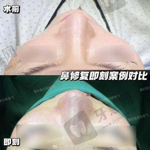三、唐山惠美登美容医院口碑评价剖析