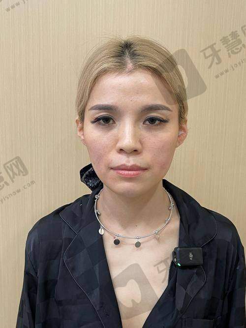 唐山释妍医疗美容整形门诊部的价格表