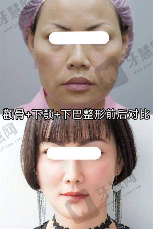 四、唐山惠美登美容医院项目特色解读