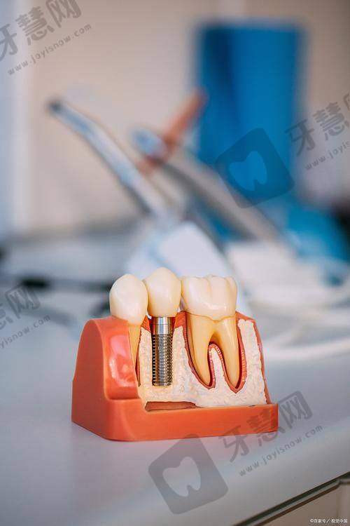 无锡口腔在线询问医生免费——无锡金铂利口腔