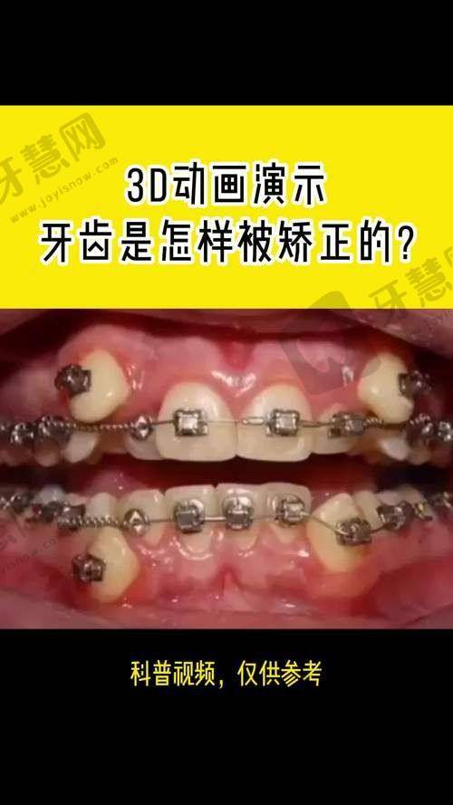 无锡十大口腔排名——无锡宜兴佳诺口腔