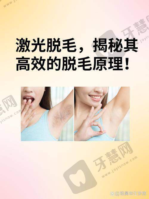 大连伊美尔美容医院激光脱毛精细选择