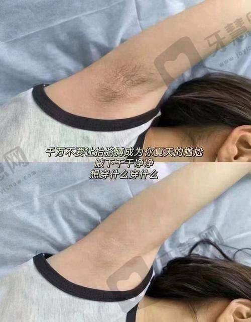 大连市沙河口区中 心医院美容科激光脱毛服务范围
