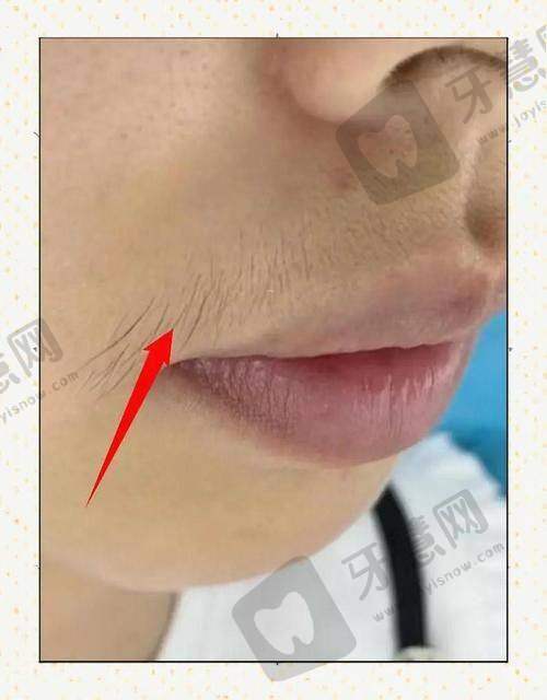 大连达美元辰医疗美容诊所激光脱毛亮点
