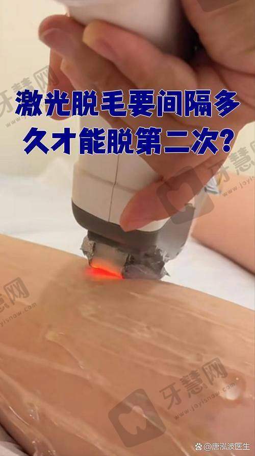 大连市友谊医院美容科激光脱毛品质