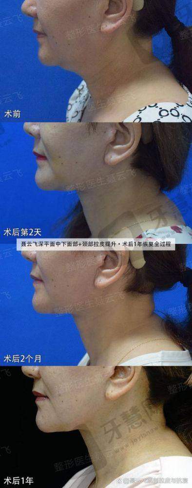 北京加减美穆宝安医生背景与资质深度揭秘
