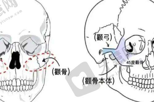 叶桐江医生富贵包治疗案例好？西安国际医学中心坐3号线就到！