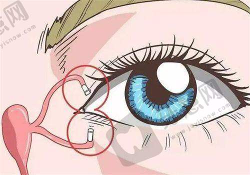 福州莳肌医疗美容诊所溶解酶的作用显著