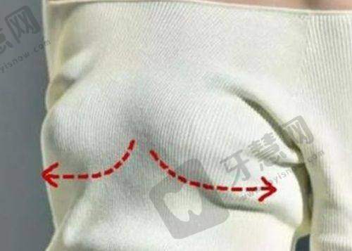 叶桐江医生减轻双眼皮手术疼痛感的措施