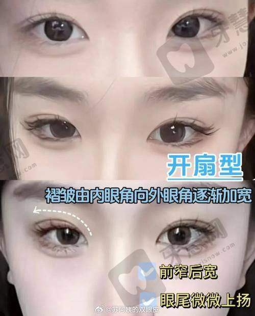 毛祥盛医生技术优势
