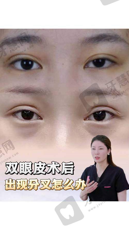 昆山容妍整形李晓燕医生预约挂号