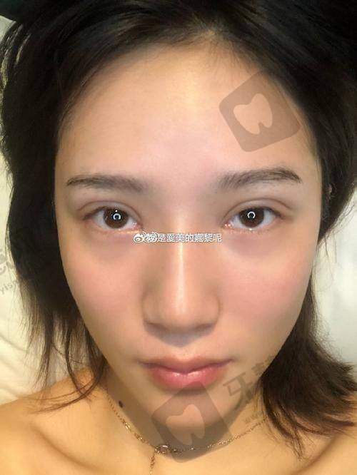 佛山顺德东王荟医疗美容医院地址电话