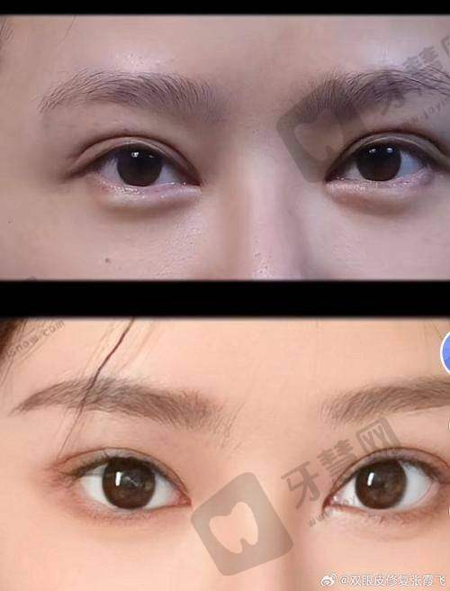 福州莳肌医疗美容诊所溶解酶的安心性有保护