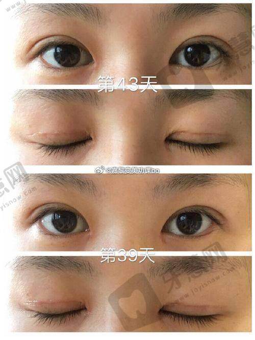 影响福州莳肌医疗美容诊所溶解酶价格的因素多样