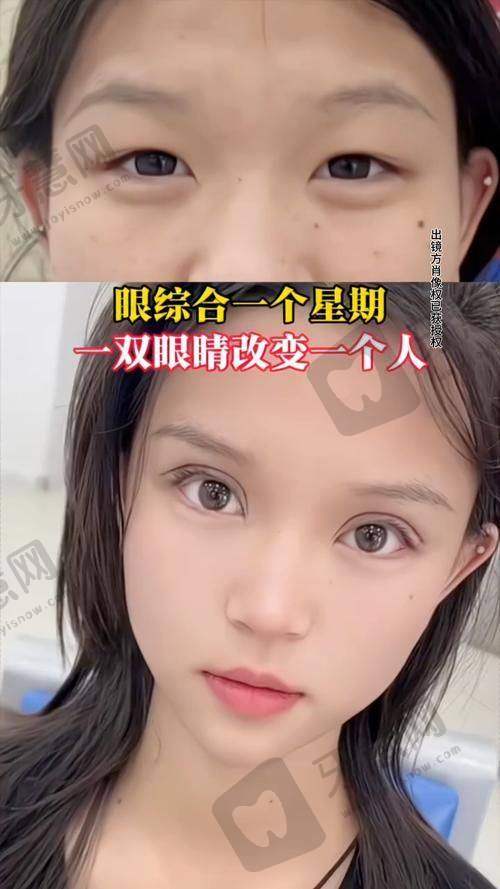 张成聪医生:综合眼部重塑骨干医生