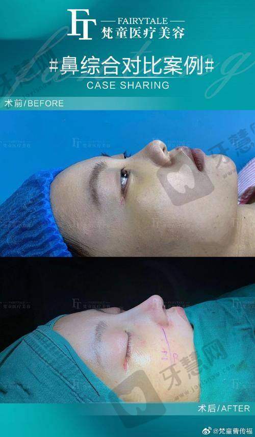 昆山容妍整形李晓燕医生价格表