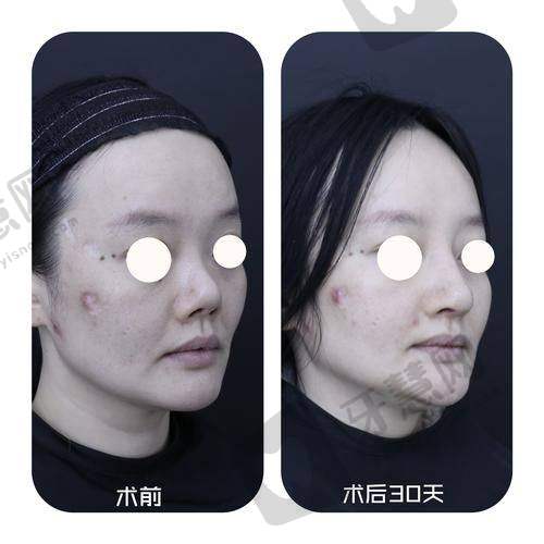 毛祥盛医生价格表