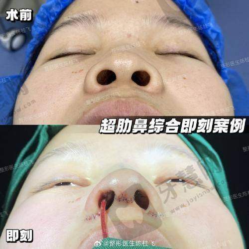 毛祥盛医生预约挂号