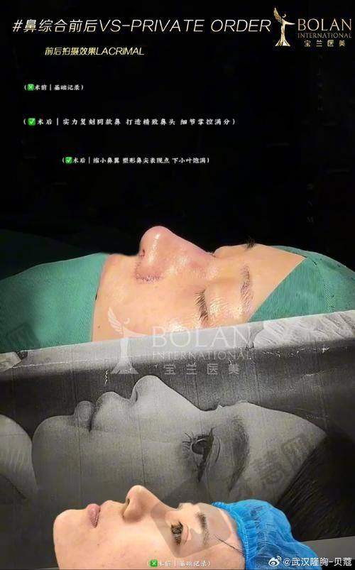郭万厚医生口碑如何