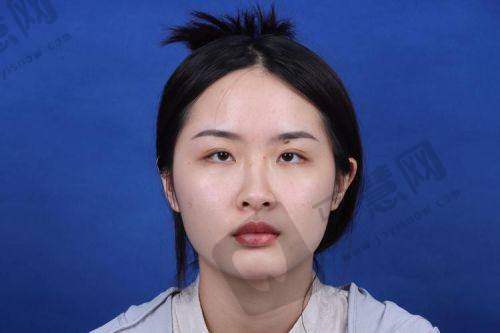 福州莳肌医疗美容诊所能打造的鼻型