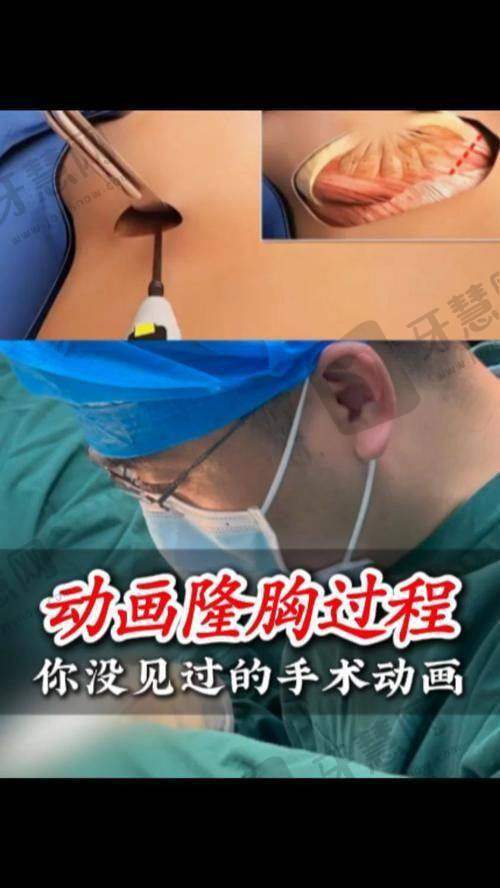 王晓娟医生口碑如何