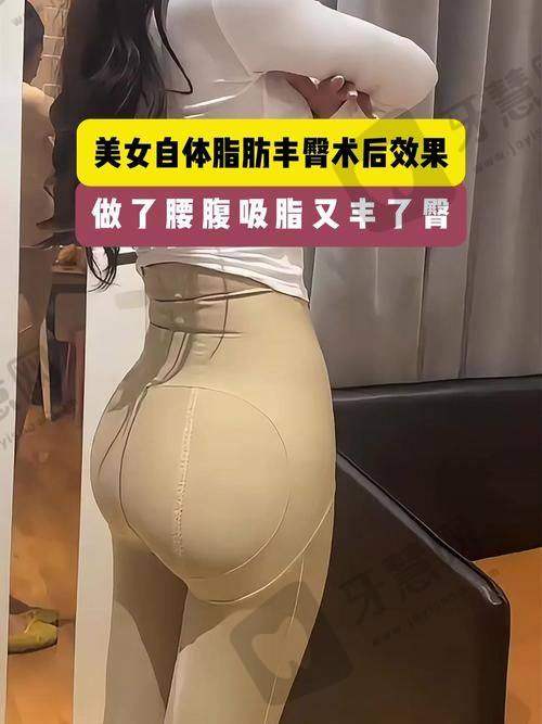 福州莳肌医疗美容诊所做射频溶脂多少钱与其他机构价格对比