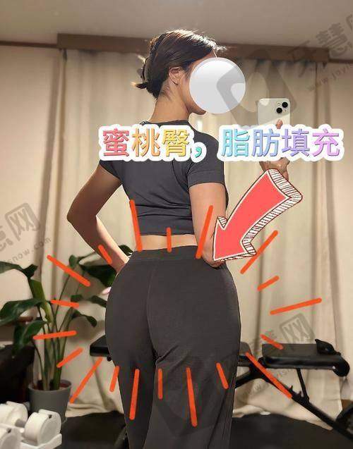 福州莳肌医疗美容诊所肉毒素瘦身术后护理要点