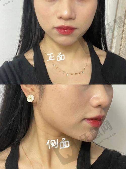 福州莳肌医疗美容诊所与其他医院的对比优势