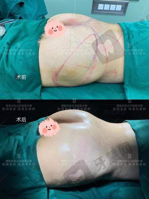 结尾