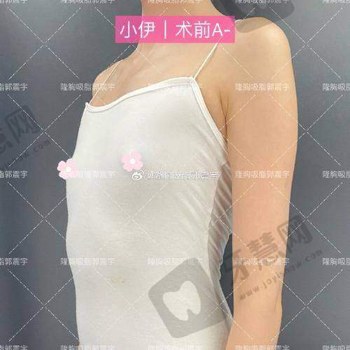 福州莳肌医疗美容诊所自体脂肪填充手术术后护理