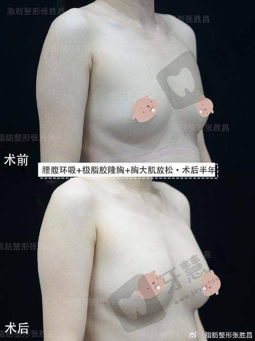 福州莳肌医疗美容诊所与其他医美机构对比