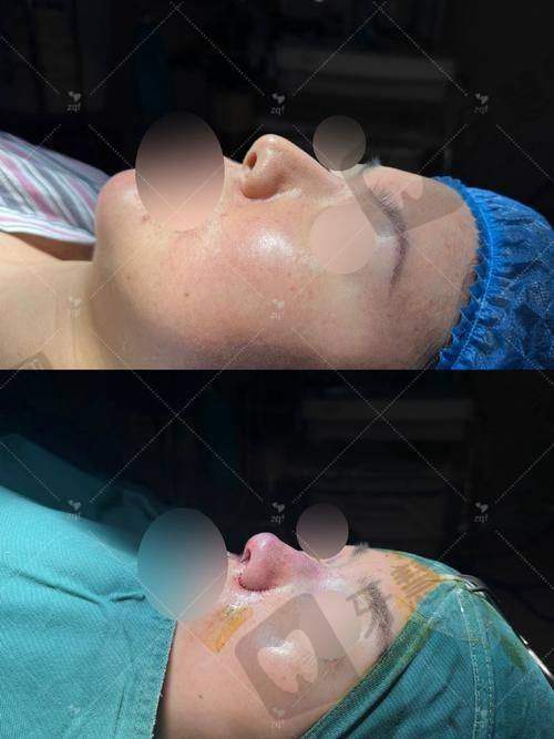 佛山顺德东王荟医疗美容医院特色技术