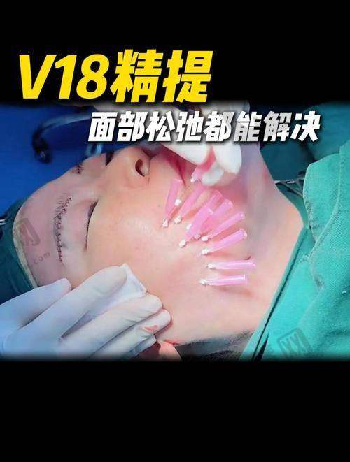 福州莳肌医疗美容诊所注射去面部细纹之品牌因素详情