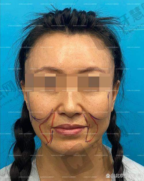 福州莳肌医疗美容诊所的未来发展趋势展望
