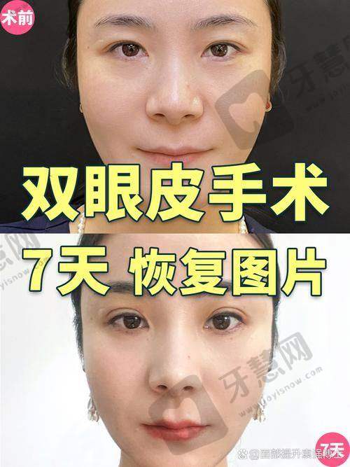 福州莳肌医疗美容诊所与其他医院对比