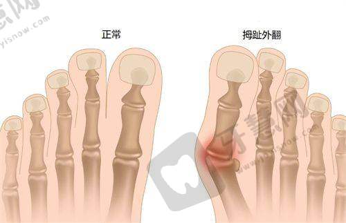 2. 韩国原辰整形外科:明星御用的隆胸隆鼻骨干医生