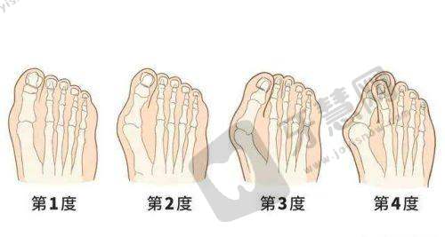 选择整形医院的注意事项