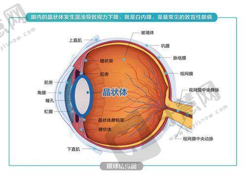 辽阳爱尔眼科医院医生简介