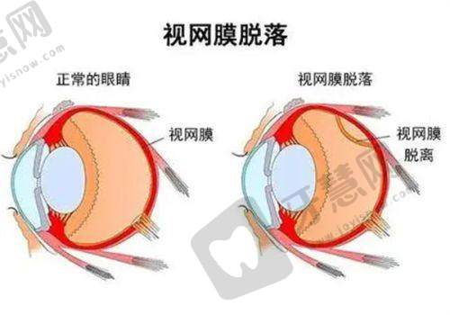 阳江爱尔眼科医院地址及乘车路线