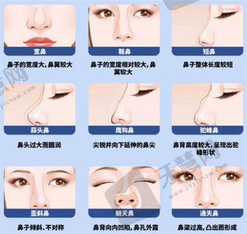 其他值得关注的韩国特色整形医院