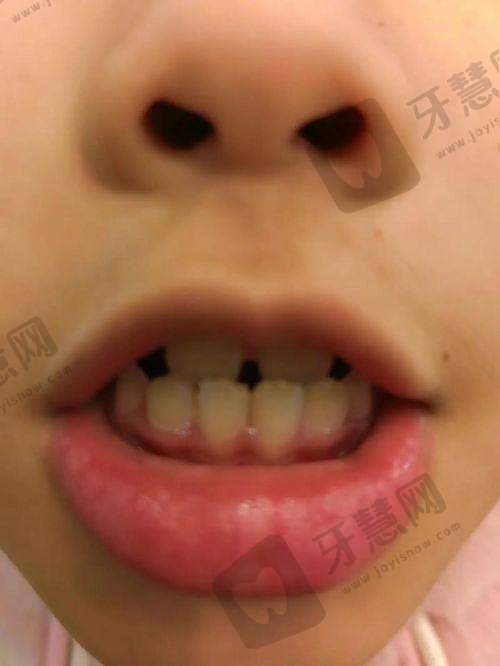 厦门美莱口腔门诊部怎么样