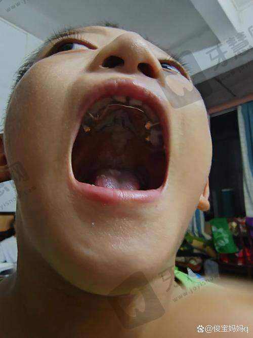 厦门小贝壳口腔门诊部更擅长什么