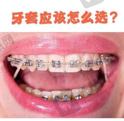 厦门美可普天使口腔门诊部怎么样