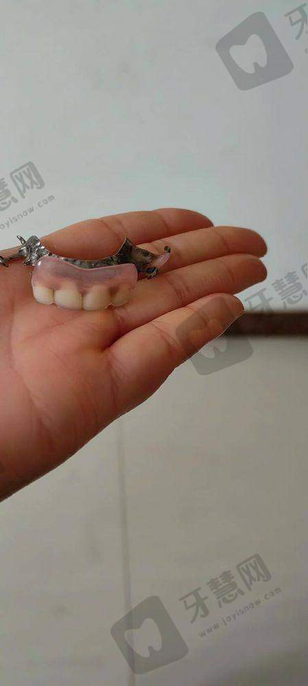厦门小贝壳口腔门诊部顾客实例