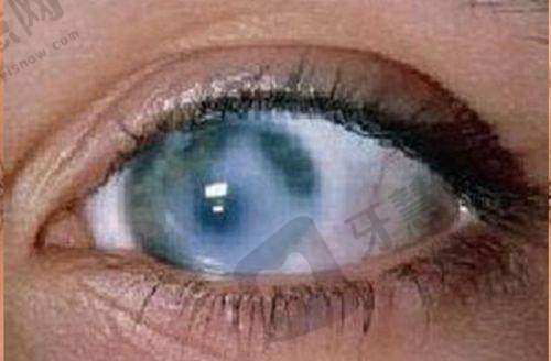 南充爱尔眼科医院地址及乘车路线