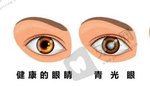 内江爱尔眼科医院地址及乘车路线