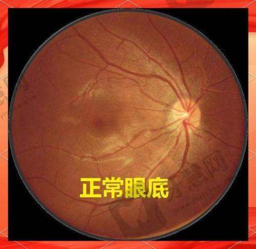 内江爱尔眼科医院项目特色